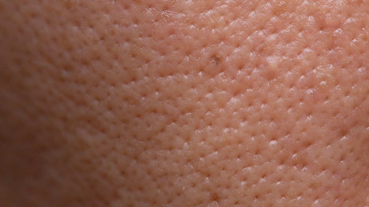 Enlarged Pores: The Complete Guide to Understanding, Minimizing, and Managing Large Pores