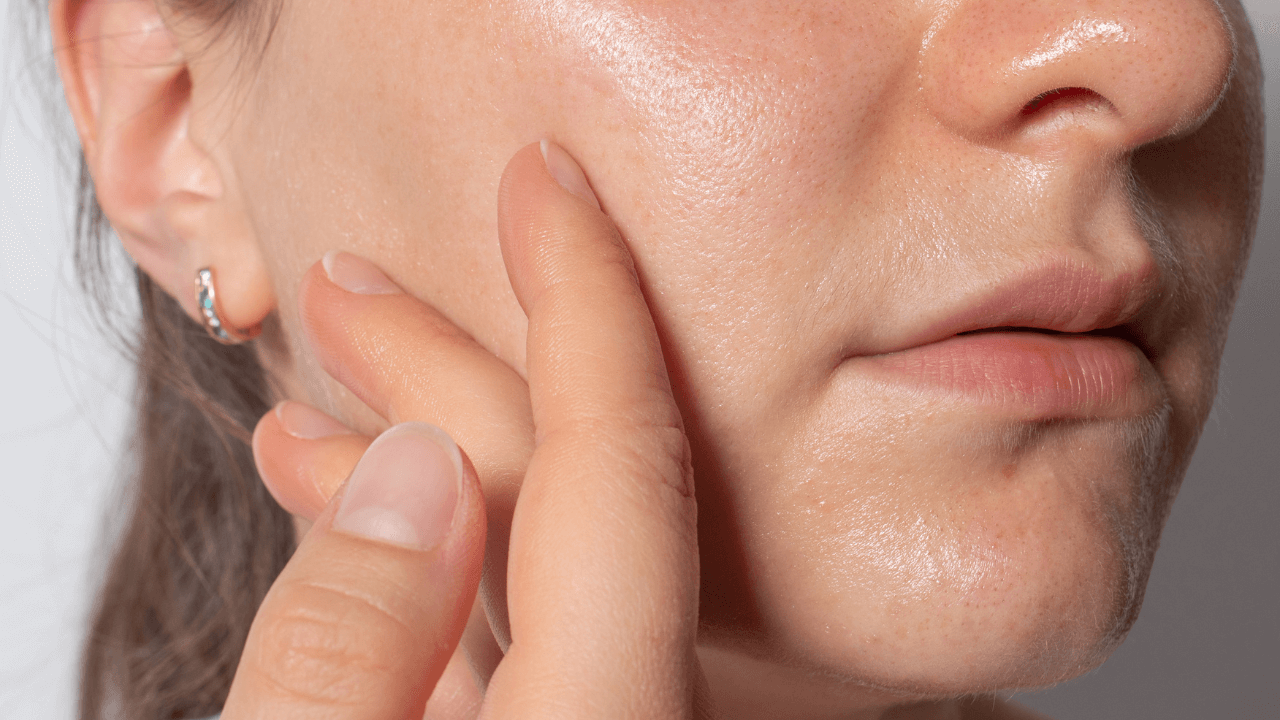 How to Control Oily Skin: Your Complete Guide to Managing Excess Oil