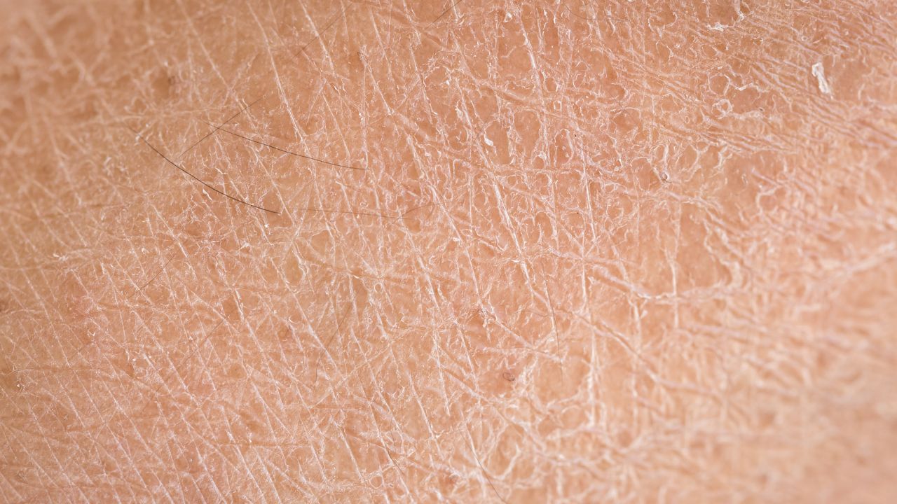 Rough Skin Texture: The Complete Guide to Achieving Smooth, Refined Skin
