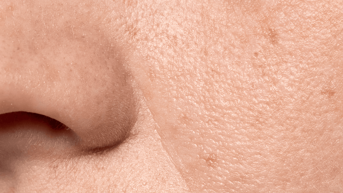 Bumpy Sakin How to Reduce Bumpy Skin: Your Complete Guide to Smoother Texture ...