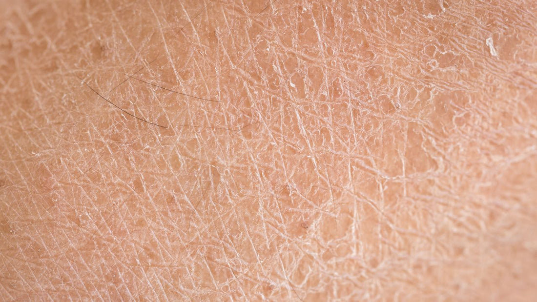 Rough Skin Texture: The Complete Guide to Achieving Smooth, Refined Sk ...