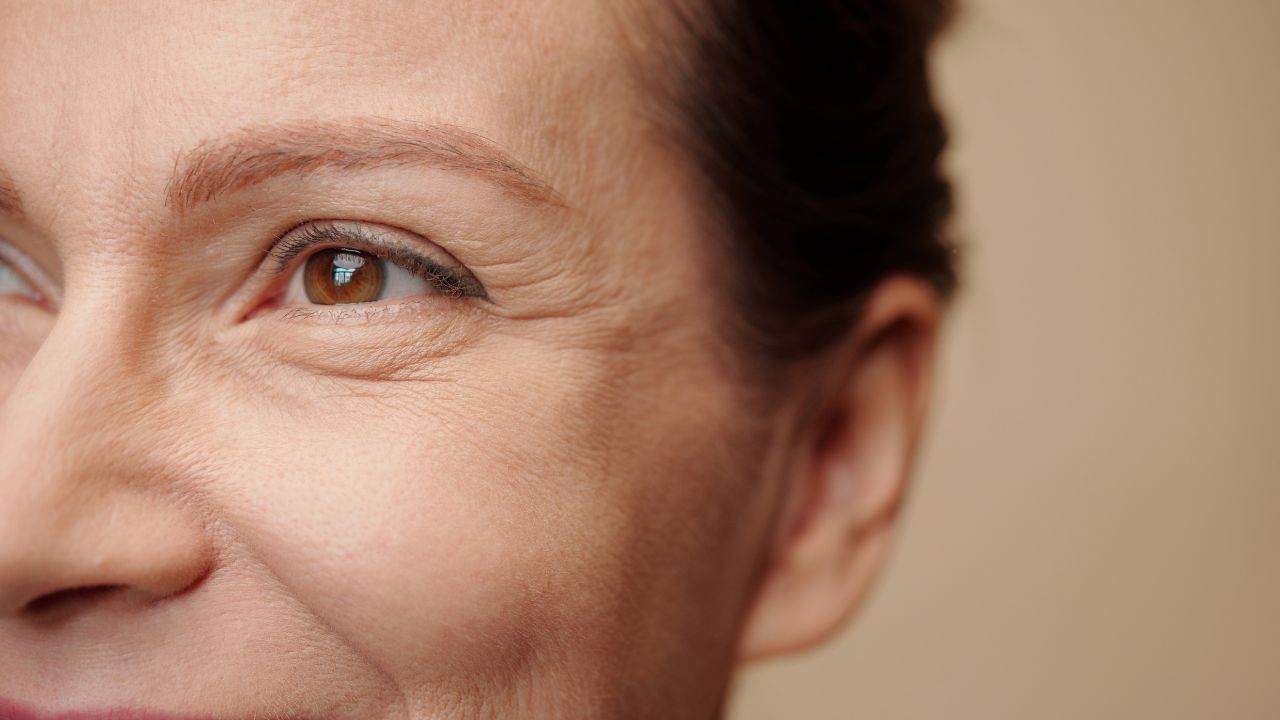Fine Lines and Wrinkles: The Complete Guide to Prevention, Treatment, and Care