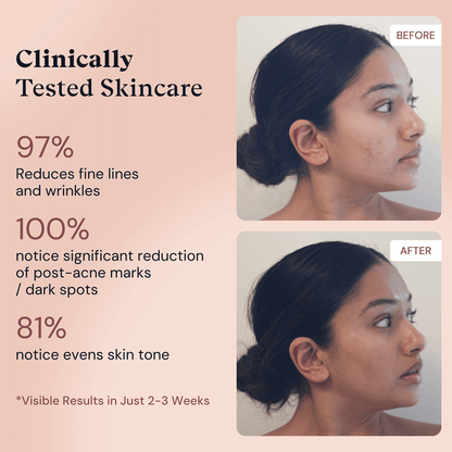 Sérum Préserve Jeunesse Rétinol + Niacinamide