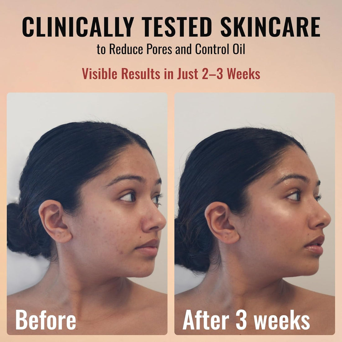 Retinol + Niacinamide Youth Renewing Serum