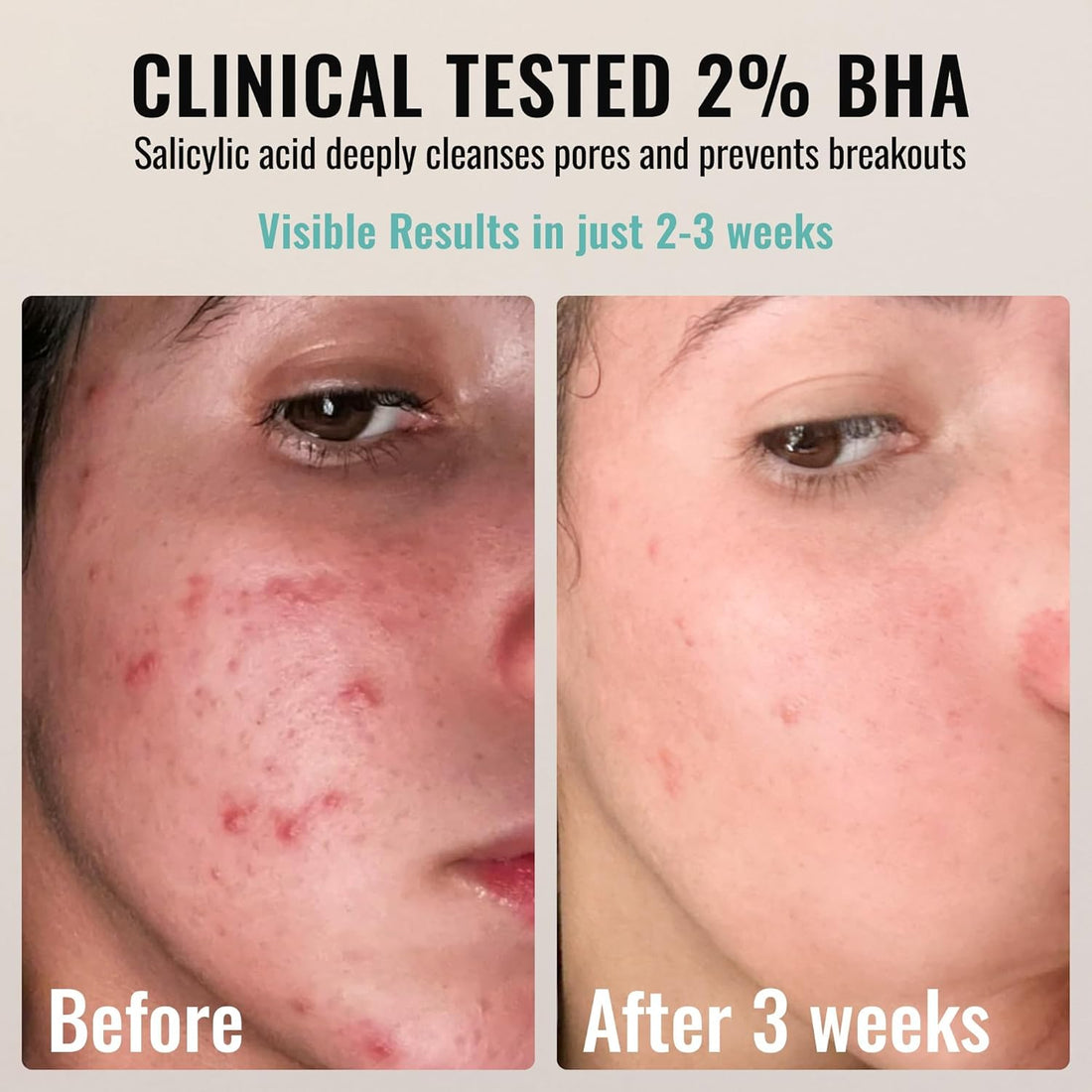 2% BHA + AHA Daily Glow Exfoliant